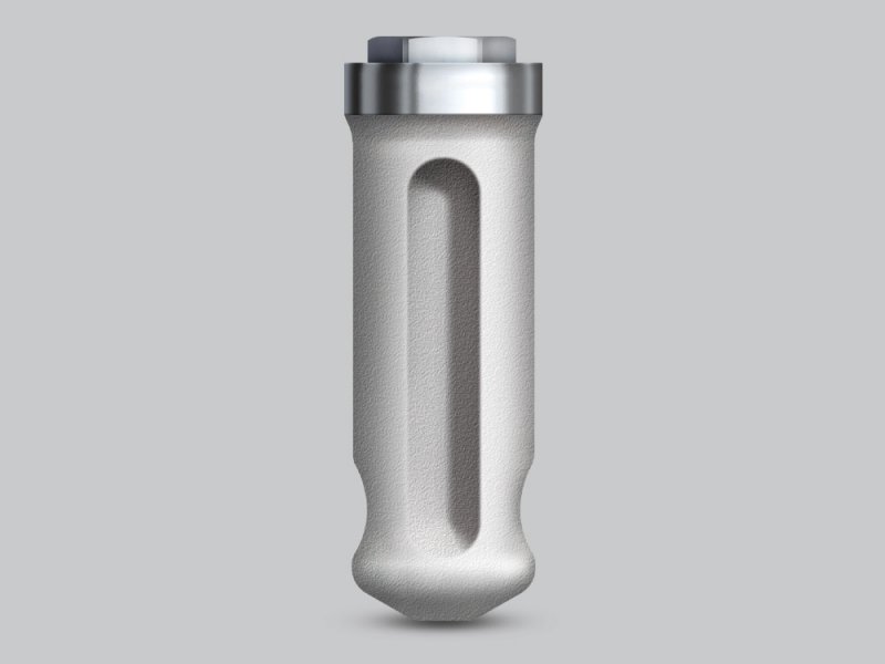 Types of Implants Tapered vs. ParallelWalled Glidewell