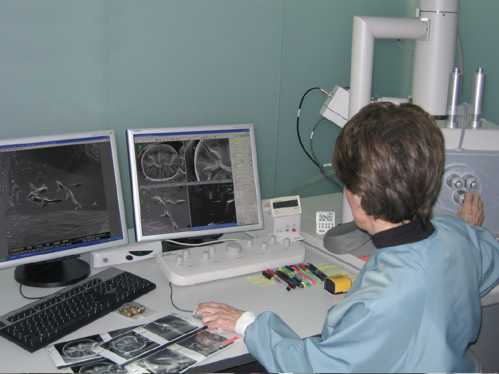 Dr. Rella Christensen’s Insights: BruxZir Zirconia after 10 Years