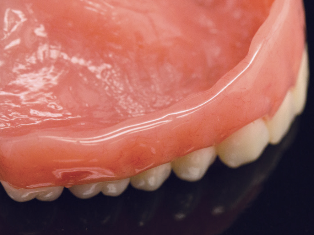 Complete Dentures: Troubleshooting Common Complaints