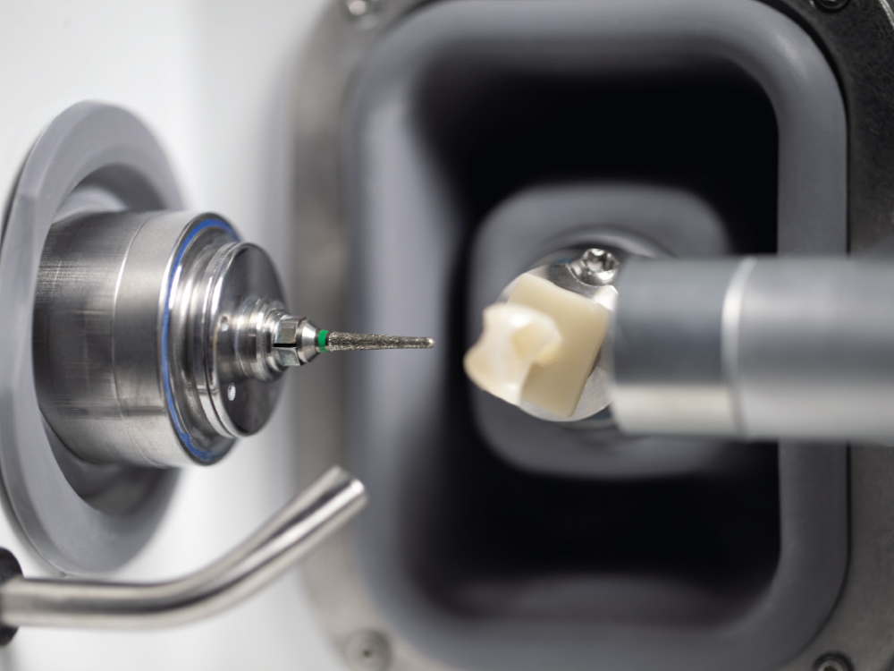 The Benefits of Chairside CAD/CAM Dental For Your Patients