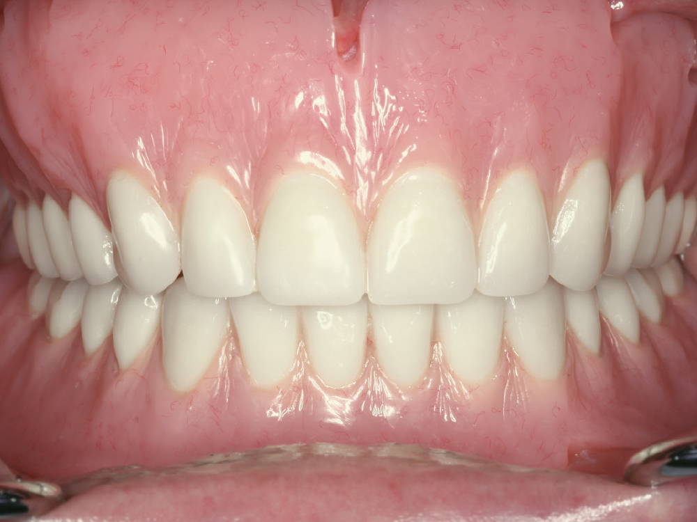 teeth-gums