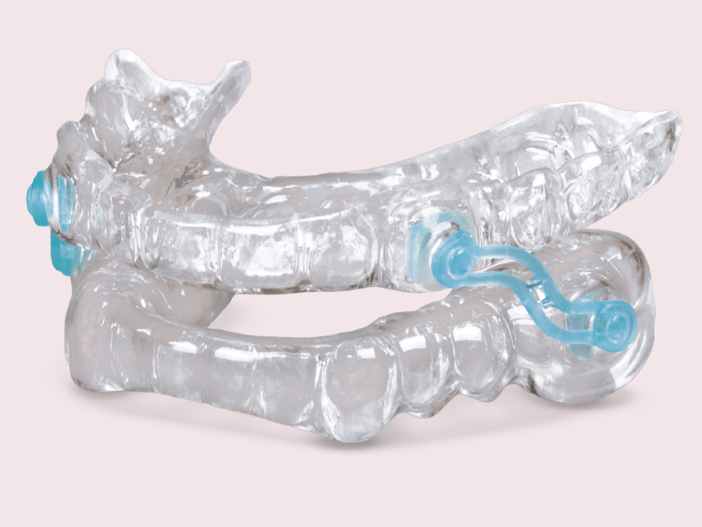 A PMAD (provisional mandibular advancement device)