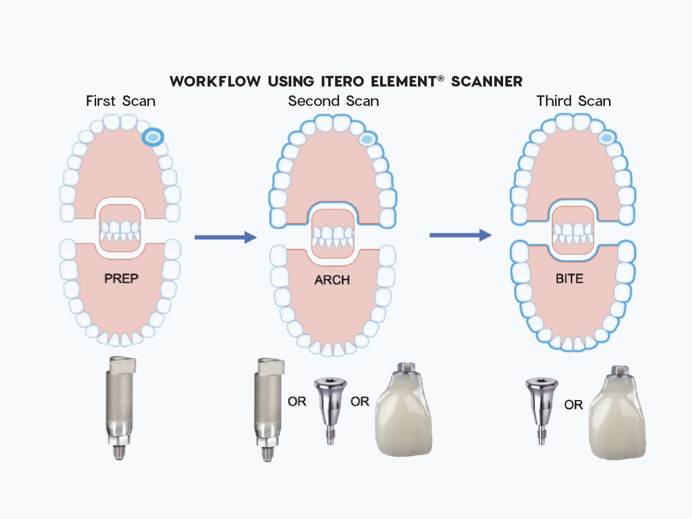Workflow using itero element® scanner