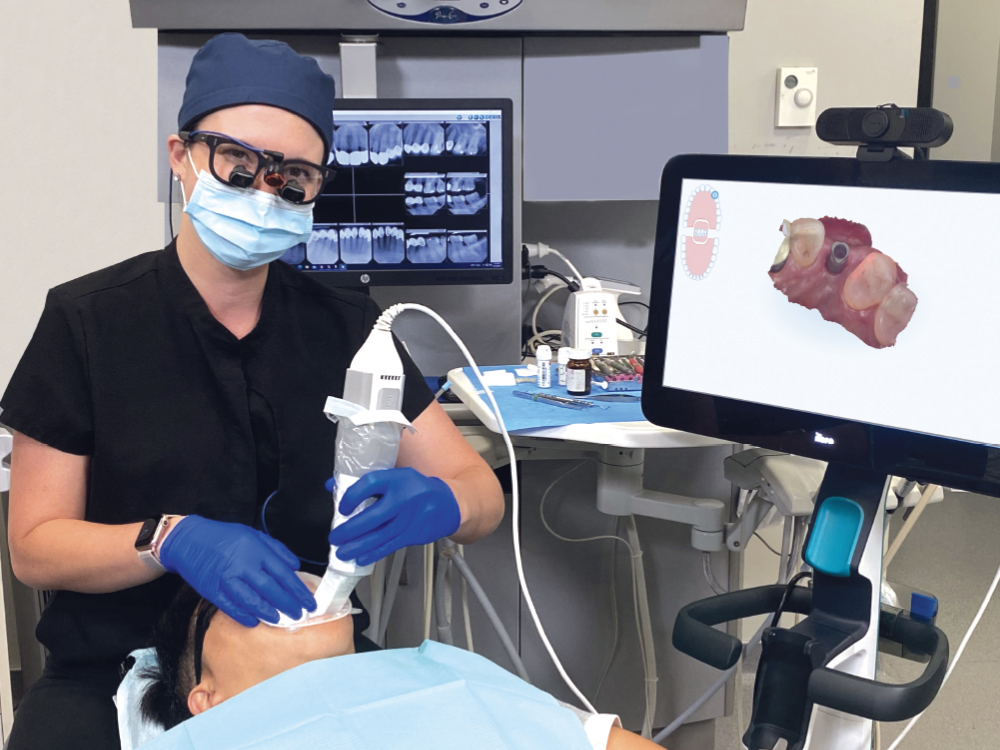 4 steps to capture accurate digital dental impressions
