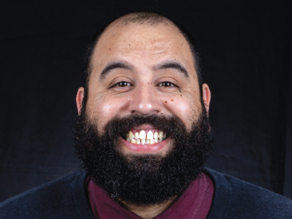 Before: Patient with periodontal disease affecting teeth