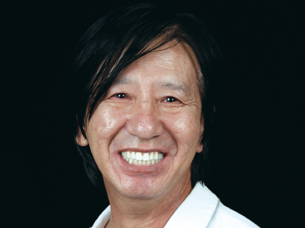 After: Patient with fixed smile with a non-removable option to replace teeth