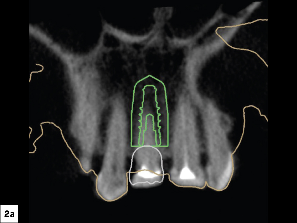 Figure 2A: CBCT scans