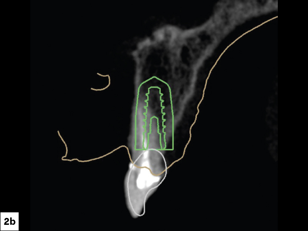 Figure 2B: CBCT scans