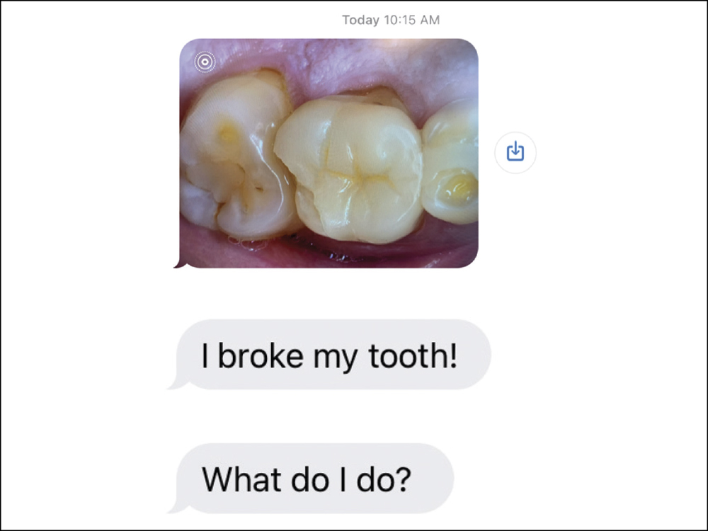 A text message in which Jinny's brother-in-law broke his tooth