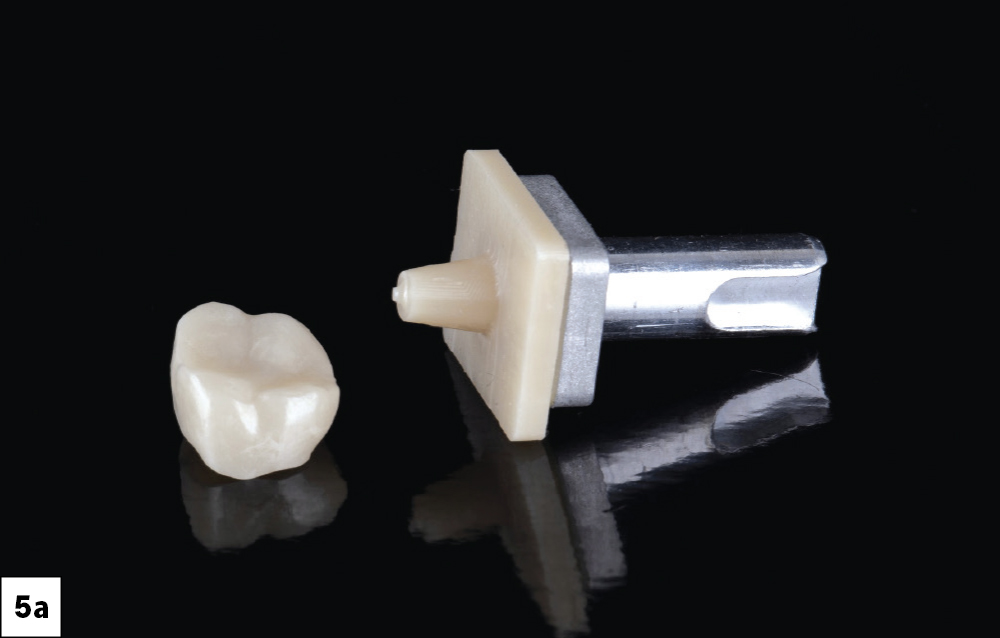 Figure 5a:BruxZir® NOW fully sintered zirconia