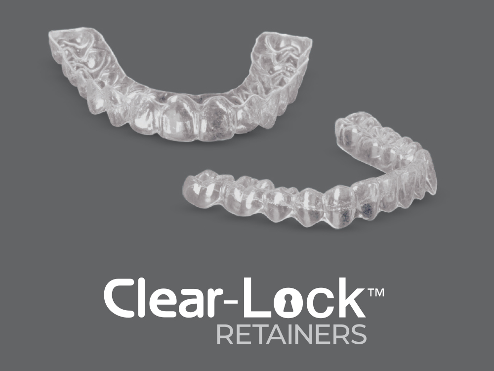 Clear-Lock Retainers