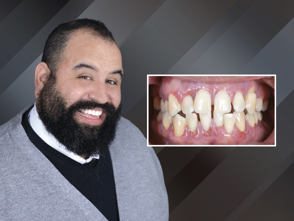 Before and after with patient's teeth