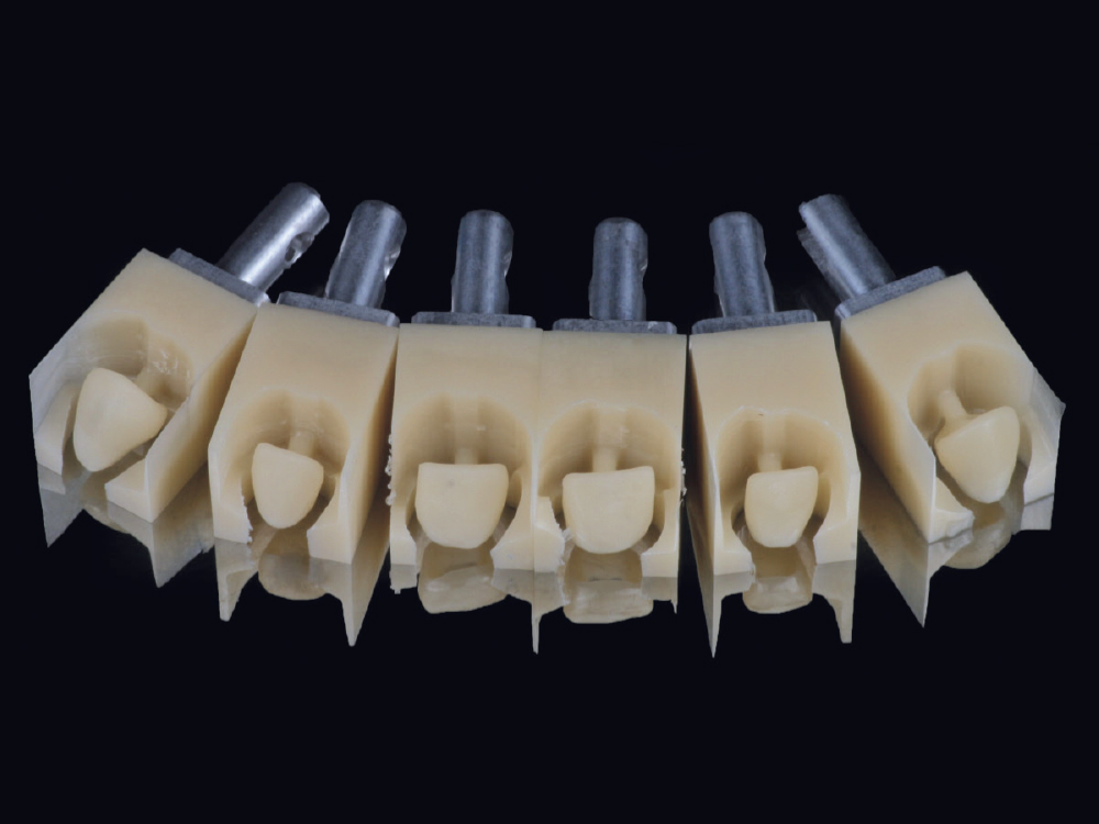 Figure 6 fastmill.ioâ ¢ In-Office Mill used to fabricate BioTemps NOW temporaries for teeth #6-11