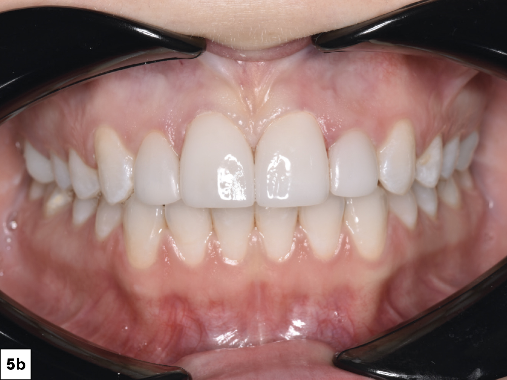Figure 5b - Patient's new smile