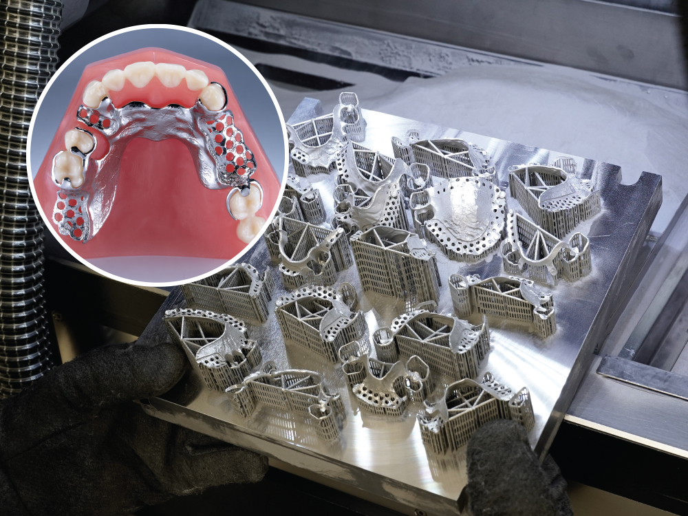 Partial dentures being made in a dental laboratory