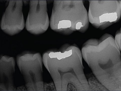 Bringing AI Into the Forefront of X-ray Analysis