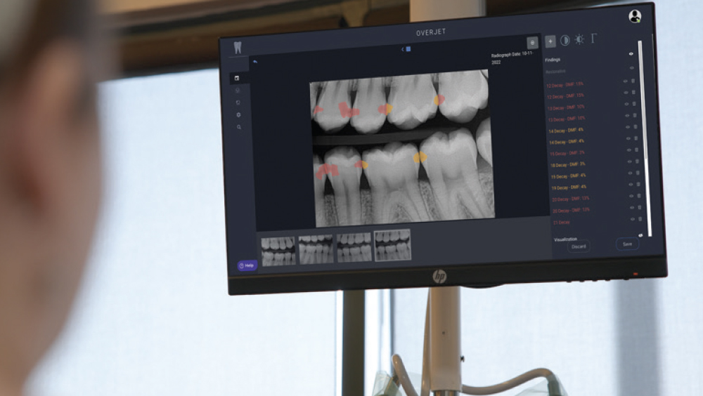 Dentist looking at an Overjet AI X-Ray