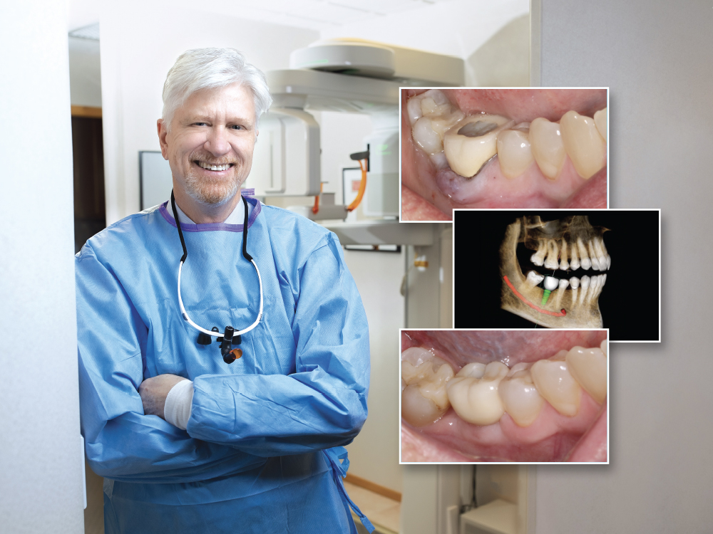 Laboratory and Chairside Partnership for a Full-Mouth Restoration