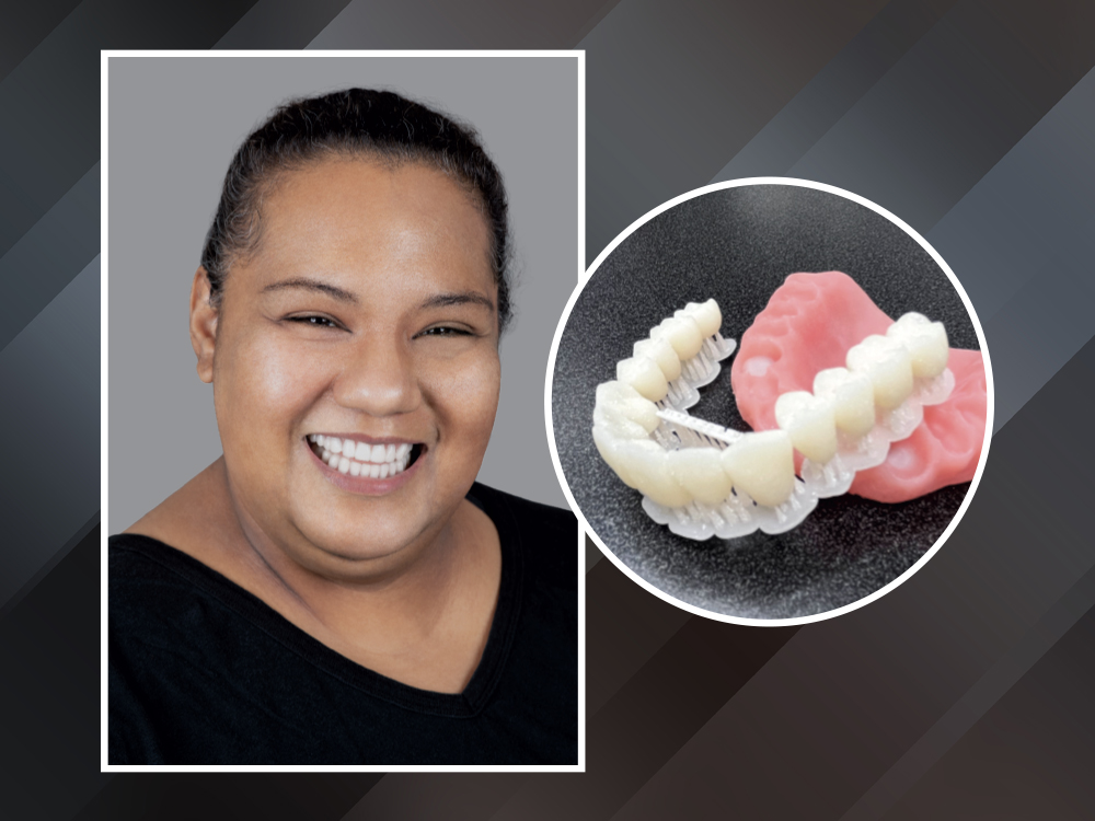 The Future of 3D-Printed Dentures at Glidewell
