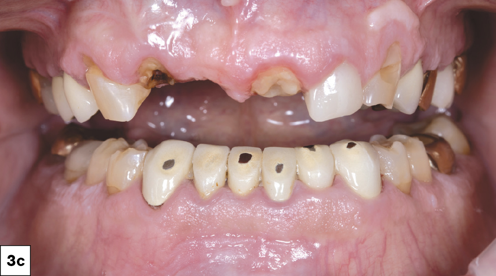 Figure 3c