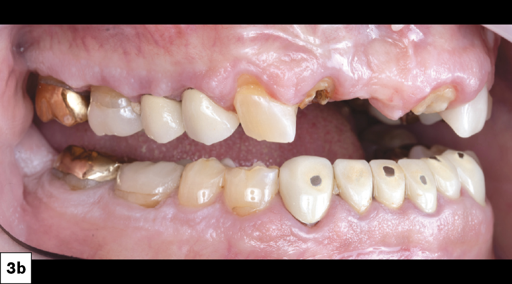 Figure 3b