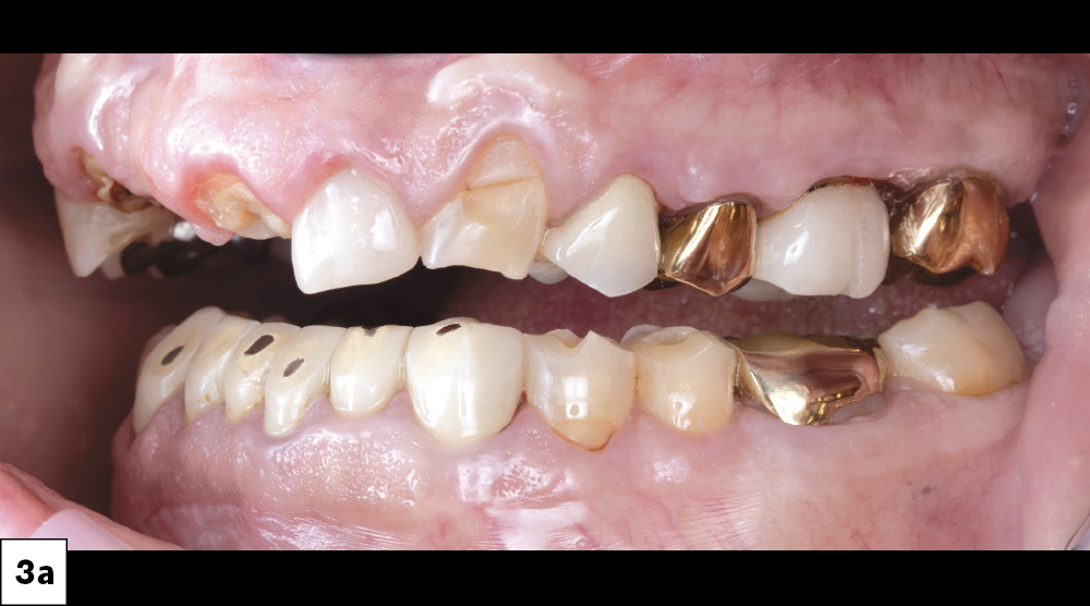 Figure 3a
