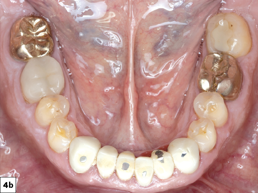 Figure 4b