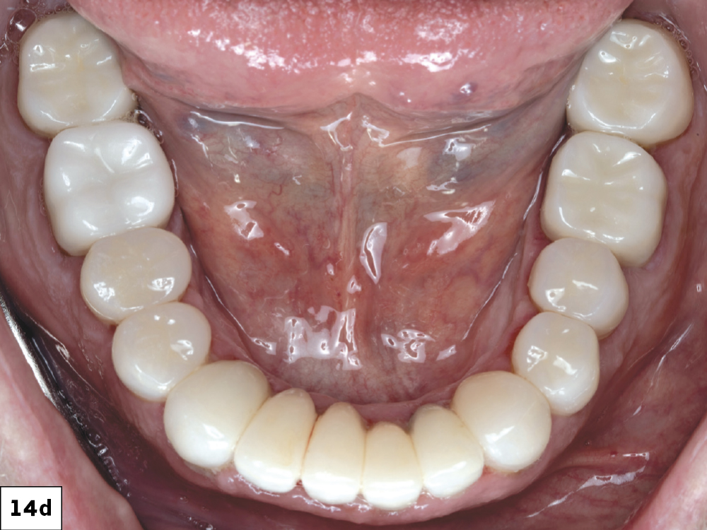 Figure 14d