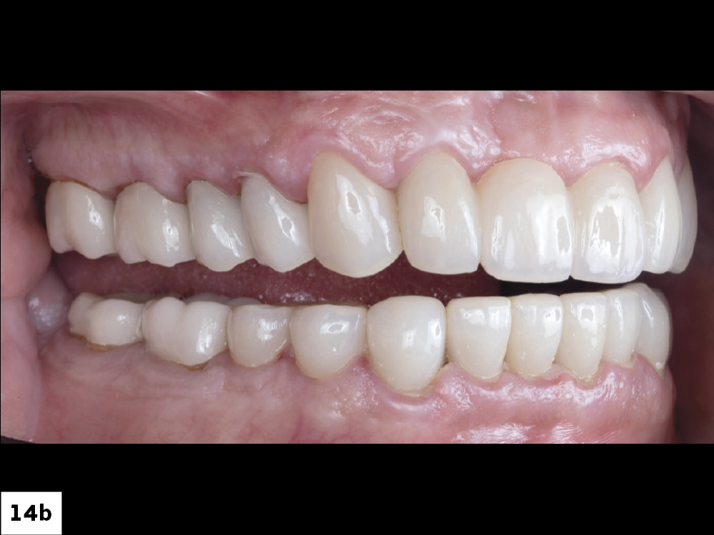 Figure 14b