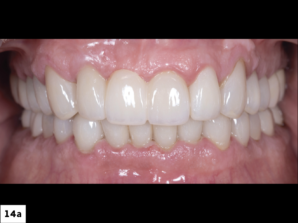 Figure 14a