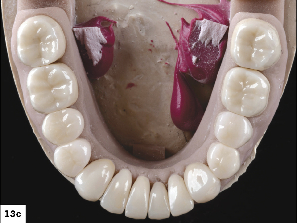 Figure 13c