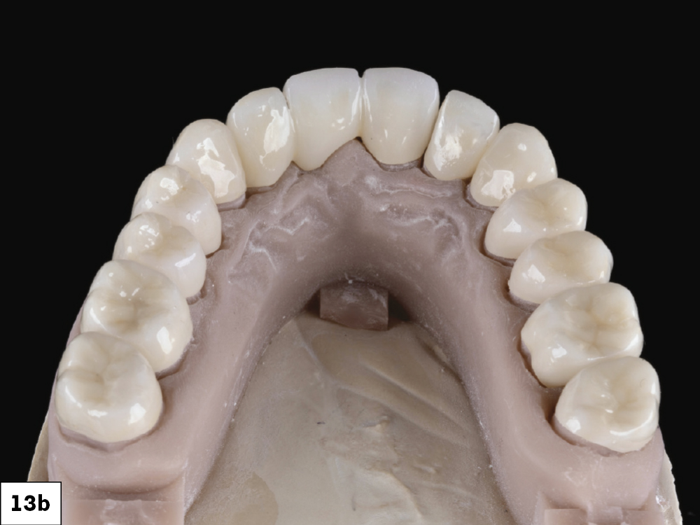 Figure 13b