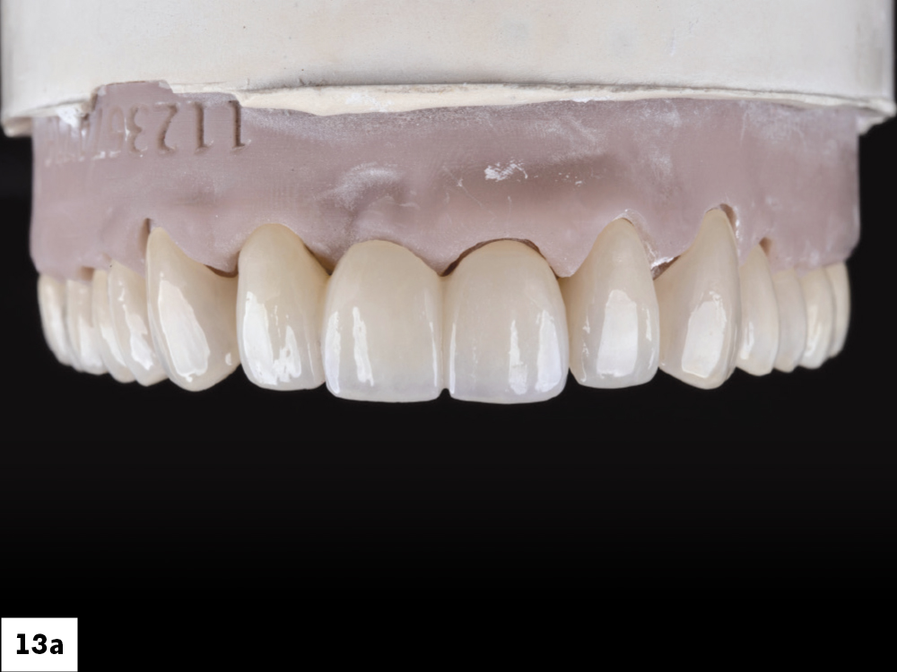 Figure 13a
