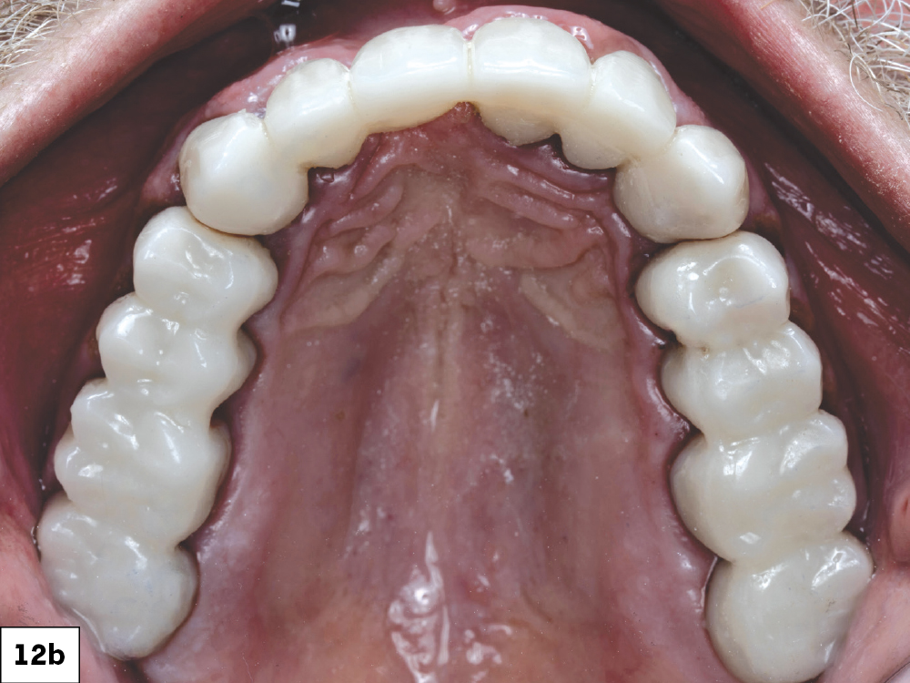 Figure 12b