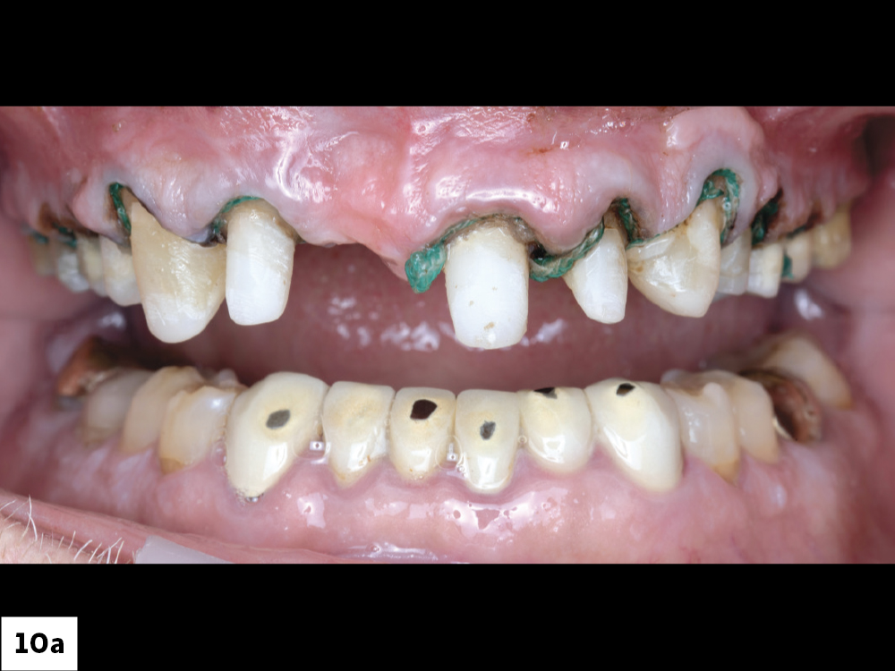 Figure 10a