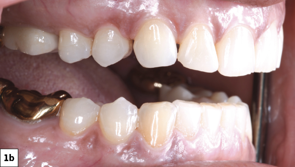Figure 1b