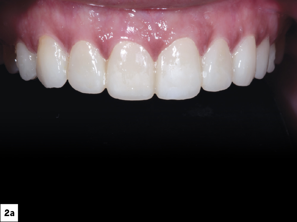 Figure 2a