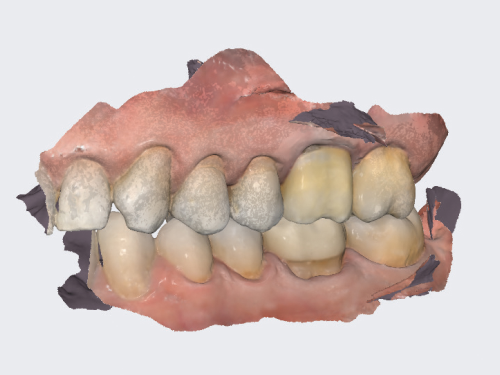 A scan of the preparation arch