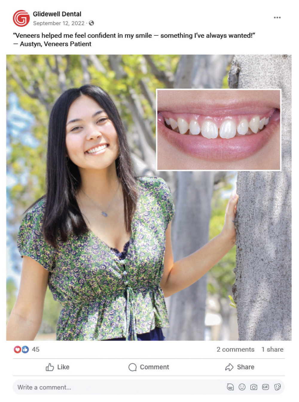 Facebook post on veneers testimonial