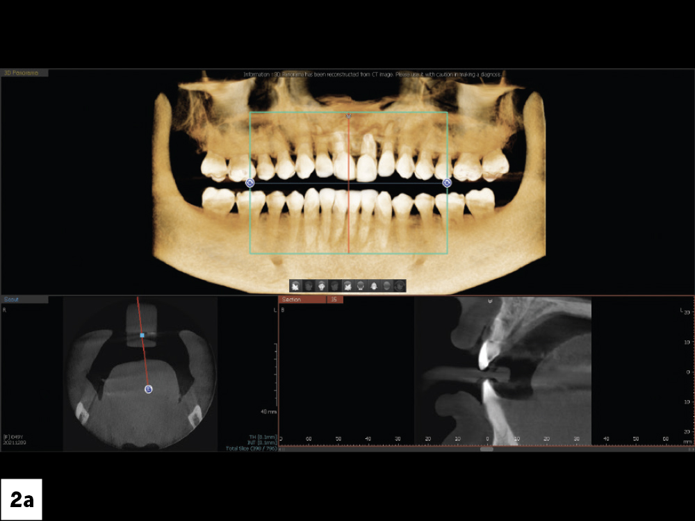 Figure 2a: CBCT scans