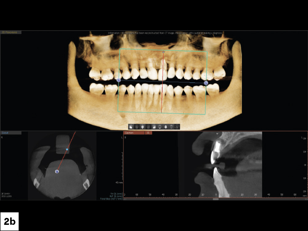 Figure 2b: CBCT scans