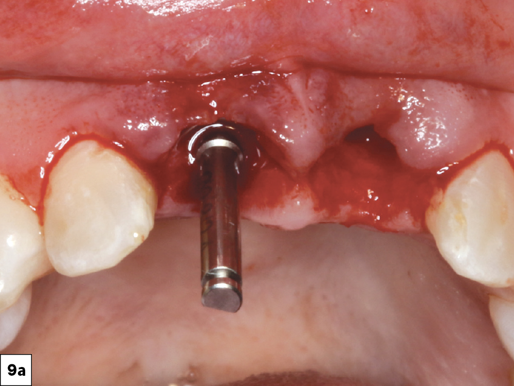 Figure 9a