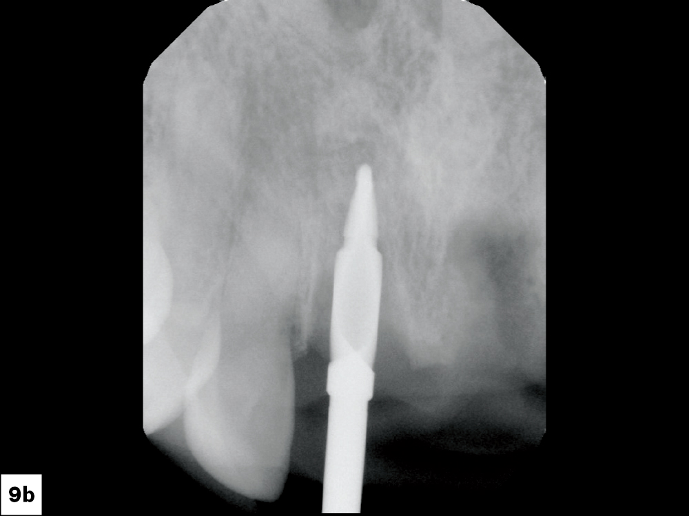 Figure 9b