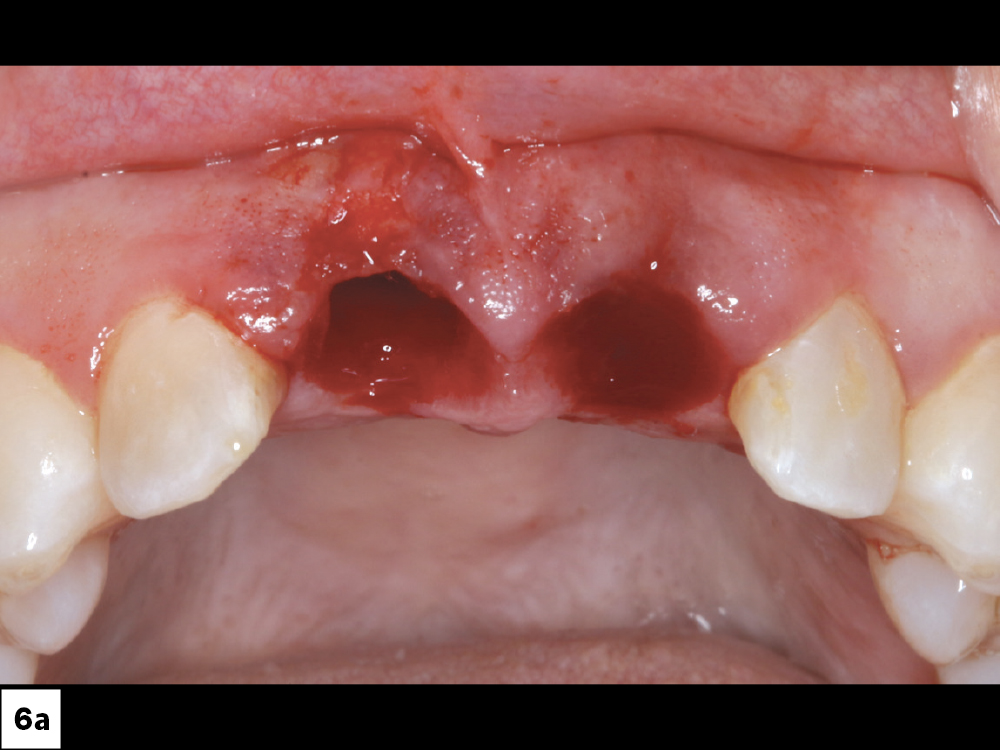 Figure 6a