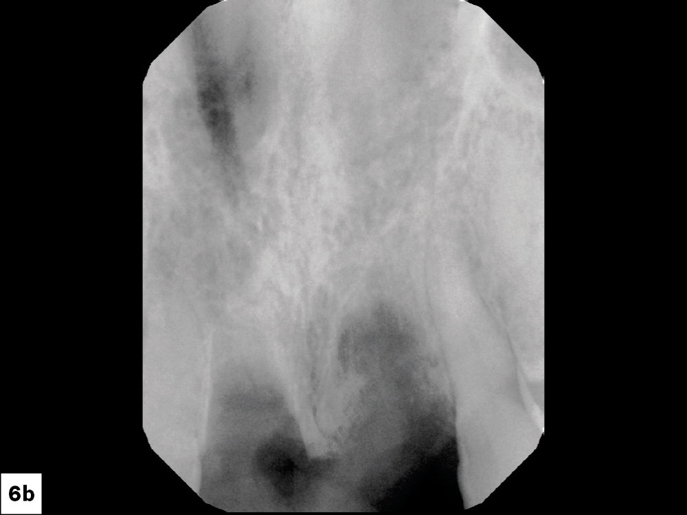 Figure 6b