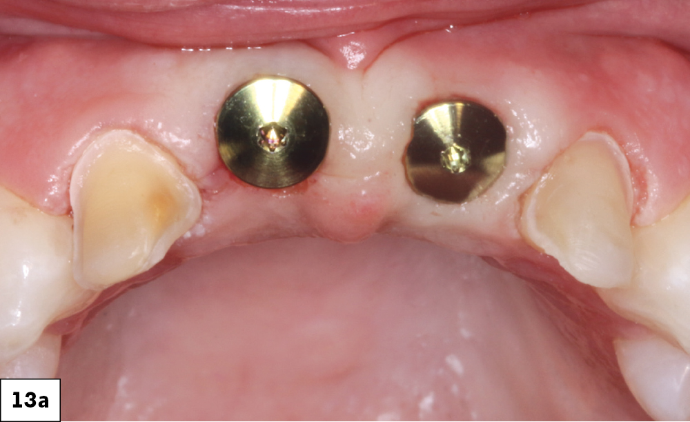 Figure 13a
