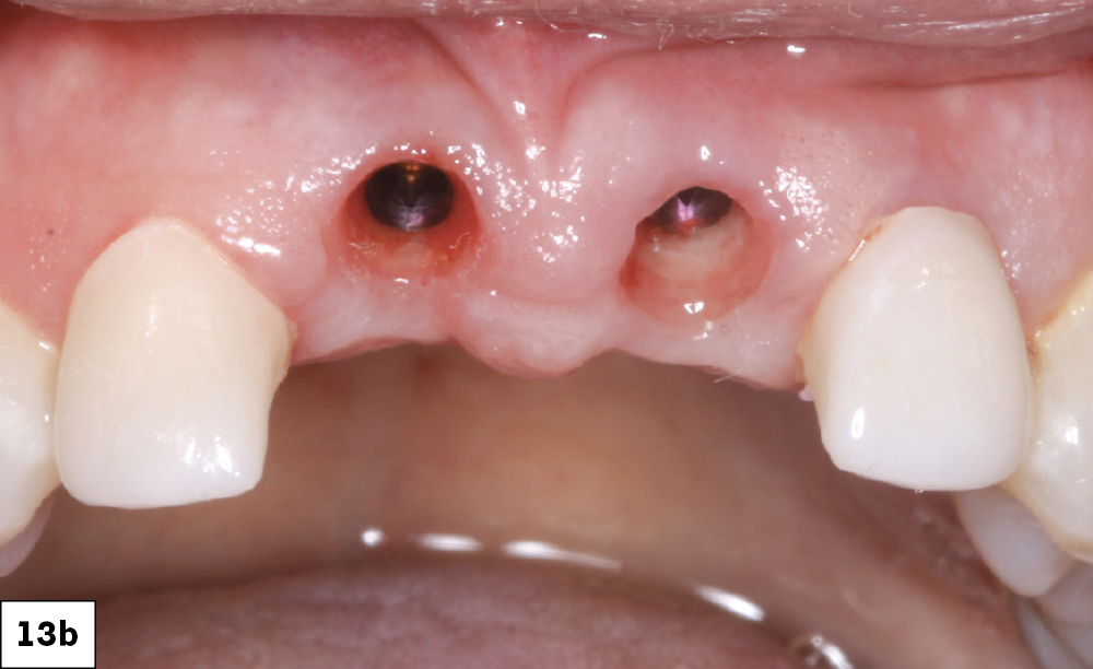 Figure 13b