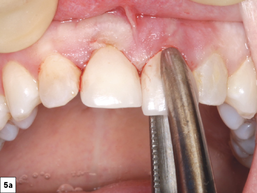 Figure 5a