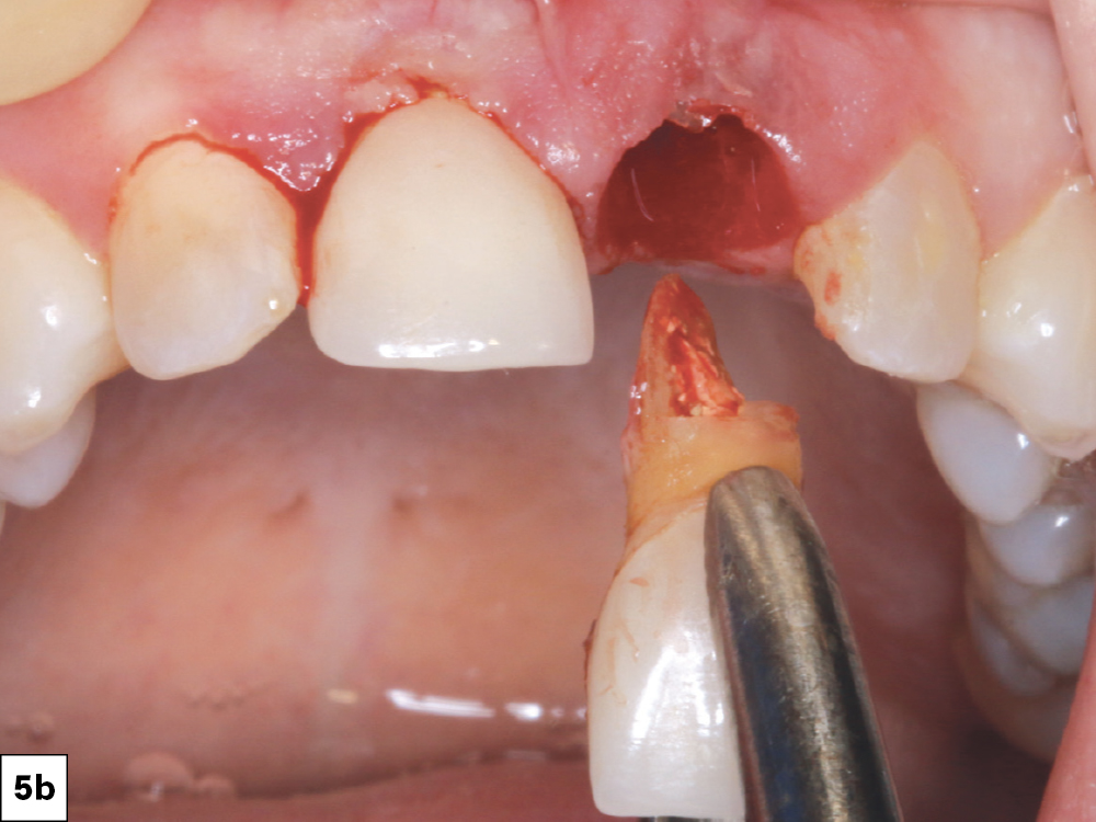 Figure 5b