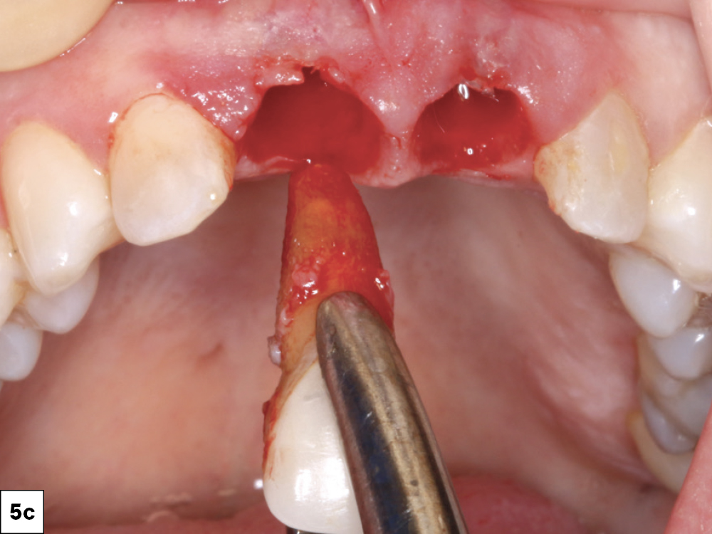 Figure 5c